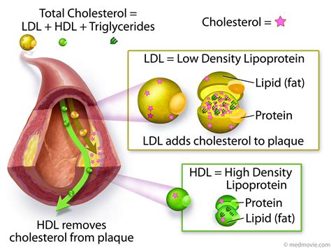 Infografika, ki pojasnjuje razliko med HDL in LDL holesterolom