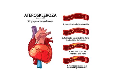infografika: stopnje pečenosti zrezka