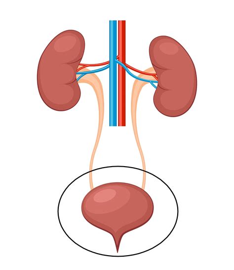 shema anatomije sečil in prikaz poti okužbe od mehurja do ledvic