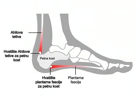 Shematski prikaz plantarne fascije na stopalu