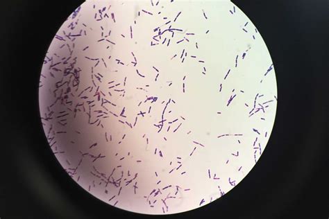 Mikroskopski posnetek bakterij Bacillus cereus