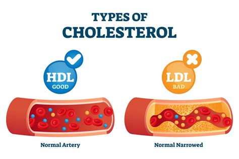 Infografika o holesterolu: HDL vs. LDL