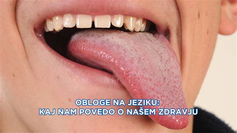 Zeljne obloge na bolečem sklepu