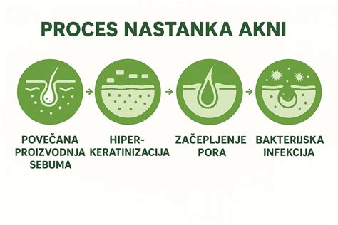 Infografika, ki prikazuje proces nastanka lukenj v siru s pomočjo bakterij in sproščanja plinov