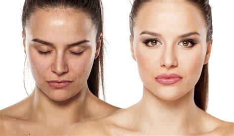 Priprava odojkove kože z zarezami