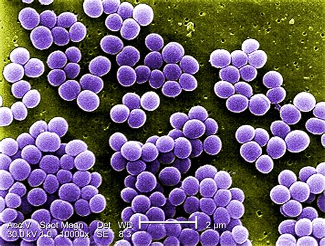 Shematski prikaz pogojev rasti bakterije Staphylococcus aureus (optimalna temperatura, pH vrednosti in aktivnost vode).