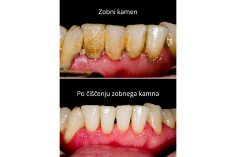 Tematska fotografija, čiščenje pizza kamna s krtačo