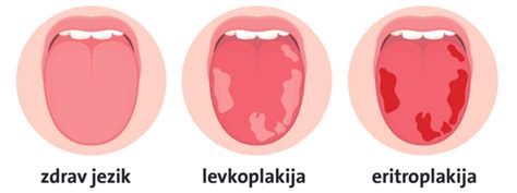Shema prebavnega trakta od ustne votline do zadnjika z označenimi ključnimi organi.