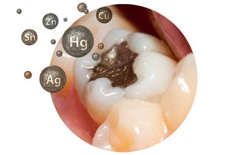 Shema vpliva živega srebra na možganske funkcije.