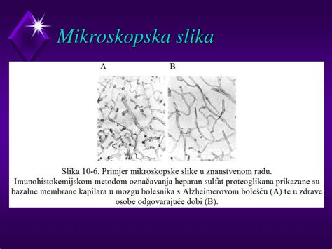 Mikroskopska slika bakterij v hrani.