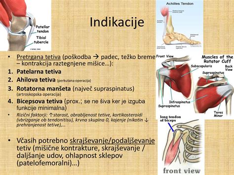 shema poškodbe prsne mišice pri piščancu (globoka pektoralna miopatija)