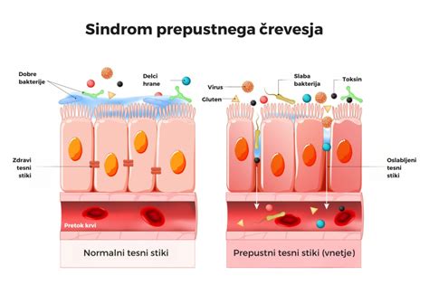 ilustracija tankega črevesa in glutenskih proteinov