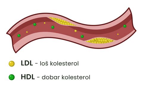 Grafični prikaz dobrega (HDL) in slabega (LDL) holesterola in njihovih učinkov na telo