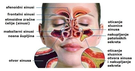 prikaz ogrcev na nosu