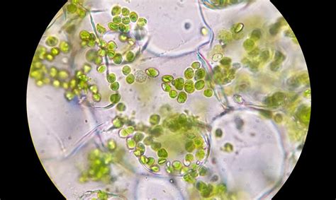 slika kvasovk pod mikroskopom