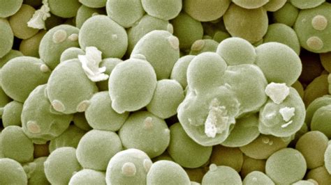 mikroskopski pogled na kvasovke Saccharomyces cerevisiae