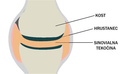 shema pasjega sklepa: prikaz hrustanca, sklepne tekočine in kosti