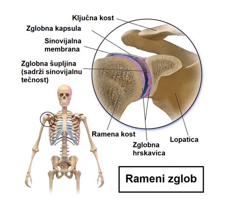 Infografika, ki prikazuje anatomijo ramenskega sklepa in kako adhezivni kapsulitis vpliva na sklepno kapsulo.