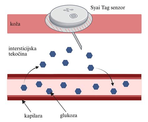 ilustracija merjenja krvnega sladkorja