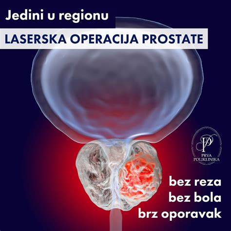 Infografika: Anatomija prostate in prikaz pogostosti benigne hiperplazije prostate (BHP) glede na starostna obdobja.