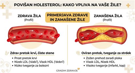 infografika: razlika med LDL in HDL holesterolom ter njun vpliv na stanje arterij