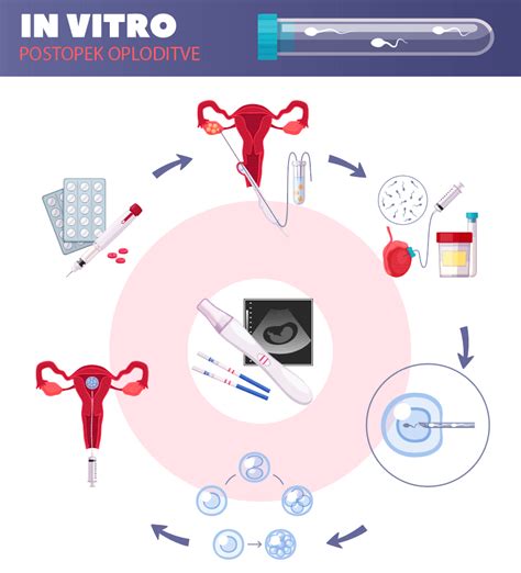 Ilustracija, ki prikazuje postopek IVF in zamrzovanje zarodkov.